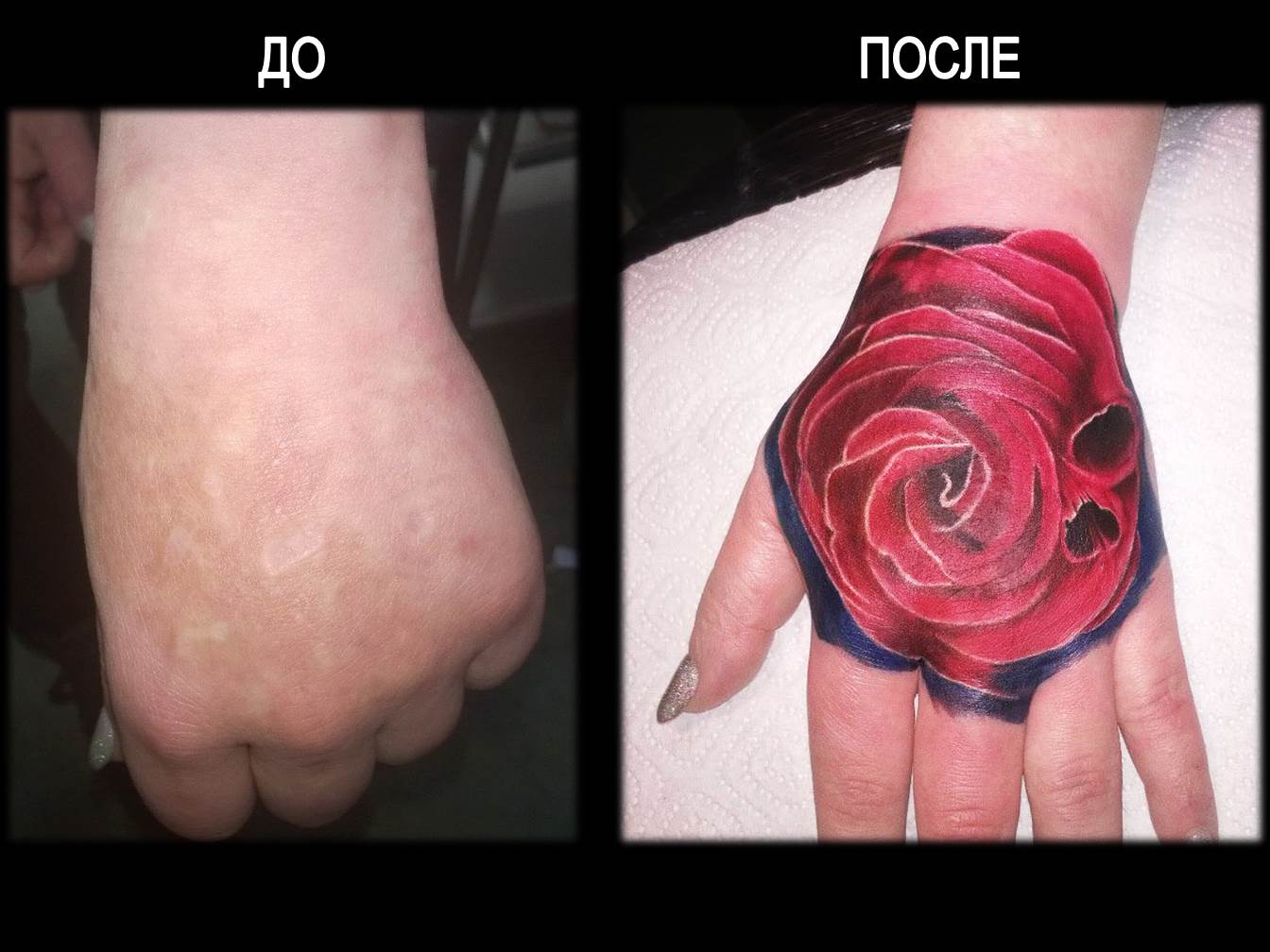 Маскировка шрамов