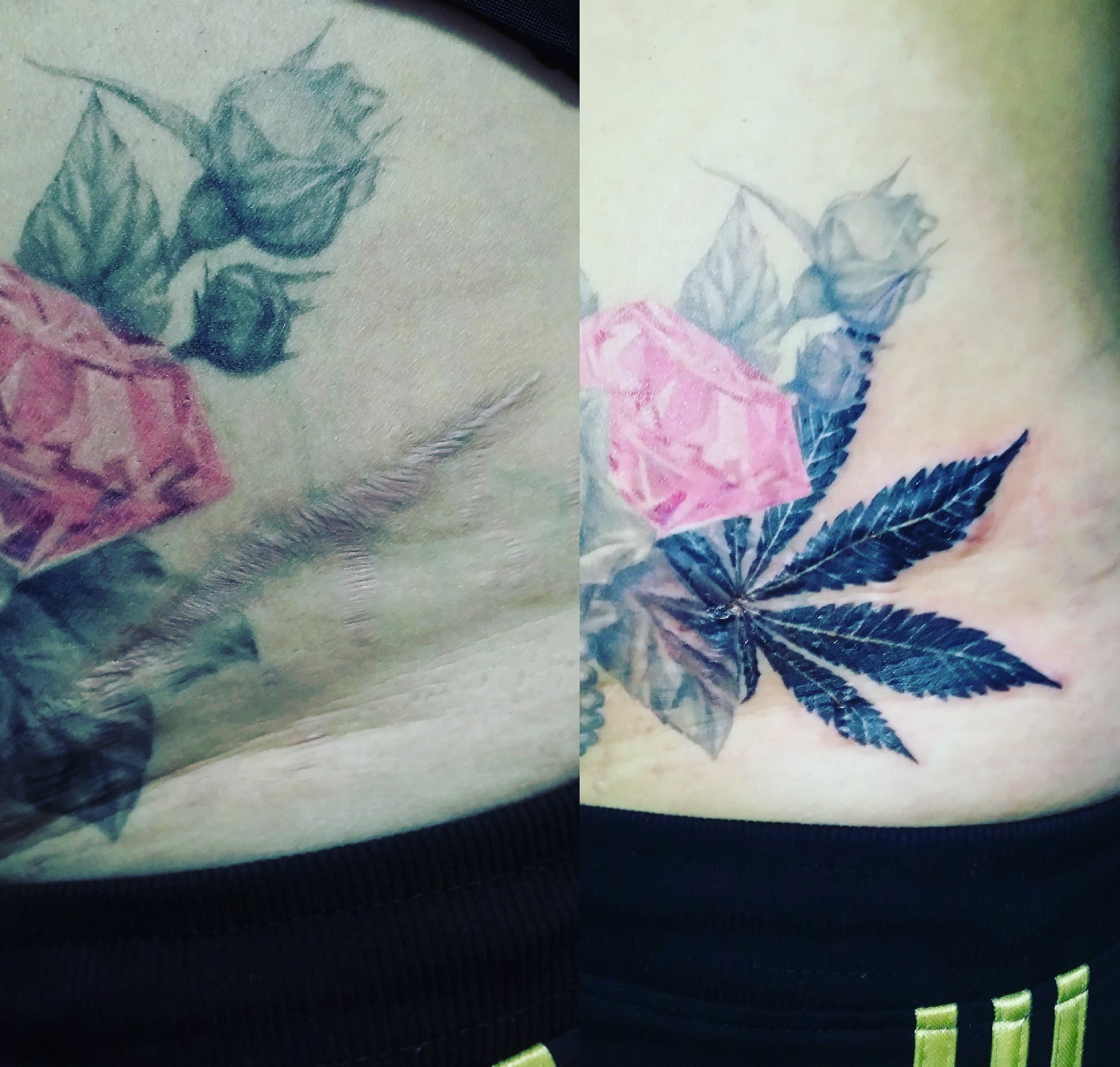 Маскировка шрамов