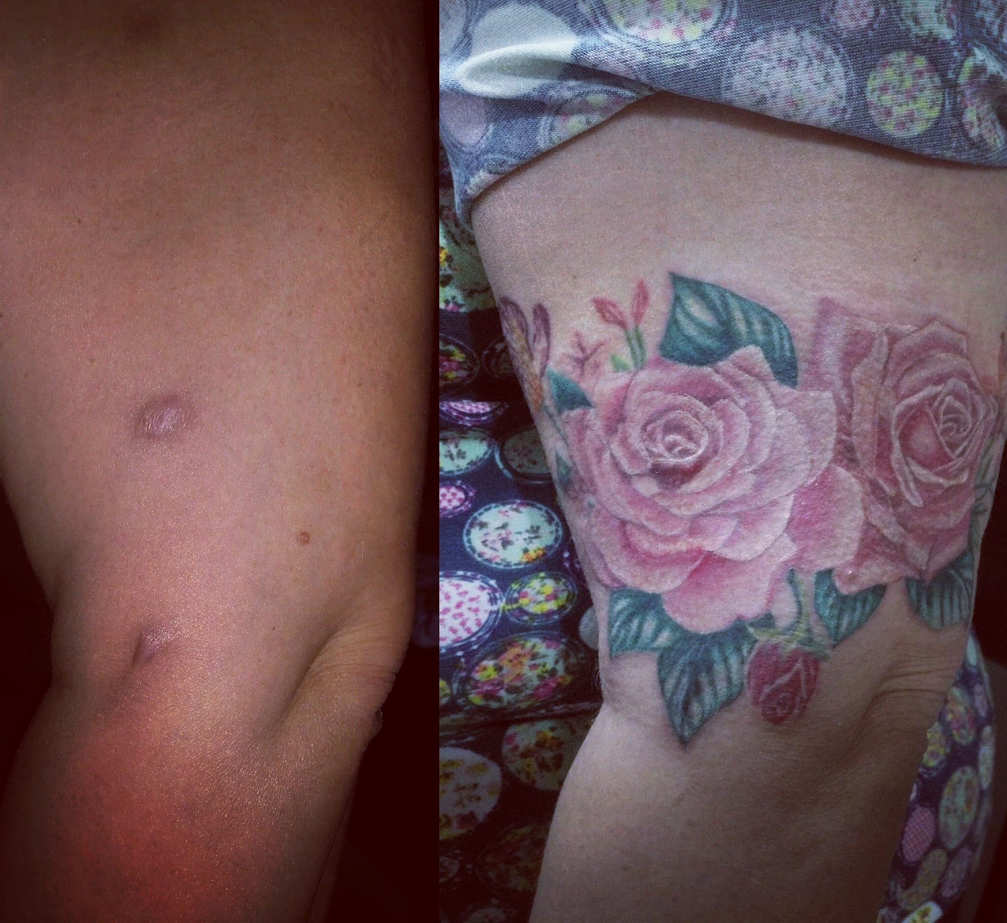 Маскировка шрамов