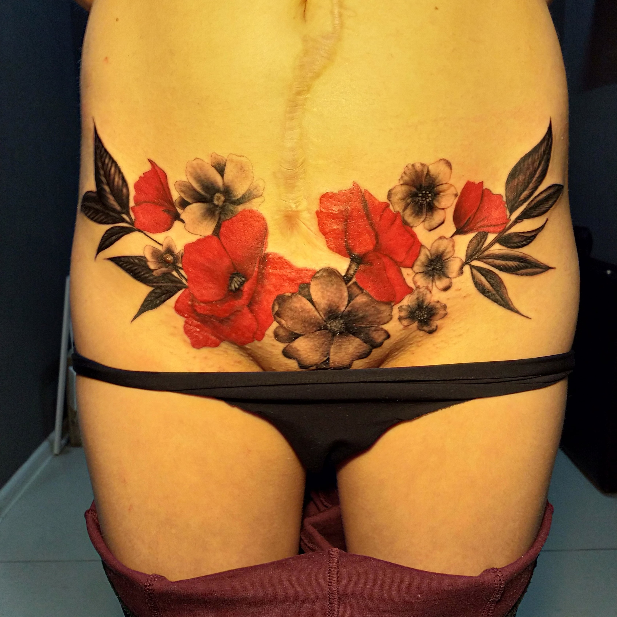 Маскировка шрамов